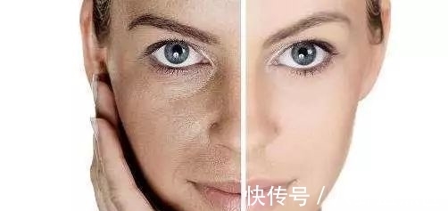 皮肤长痘、暗沉,还有大大的黑眼圈?年后紧急护肤大法教给你!