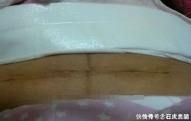 为什么很多女明星宁愿剖腹产也不选顺产呢这三个原因挺无奈的