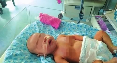 母乳|五个月女婴双肾长满结石,只因刚出生三天,父母就开始做这件事