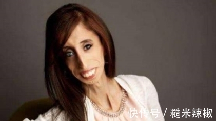 丽斯|她是世界上最瘦最丑的女人，体重不超过29公斤，却活出最美丽样子