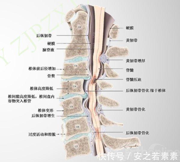 碳酸饮料|解决颈椎病的方法，就这么简单，你学会了吗？