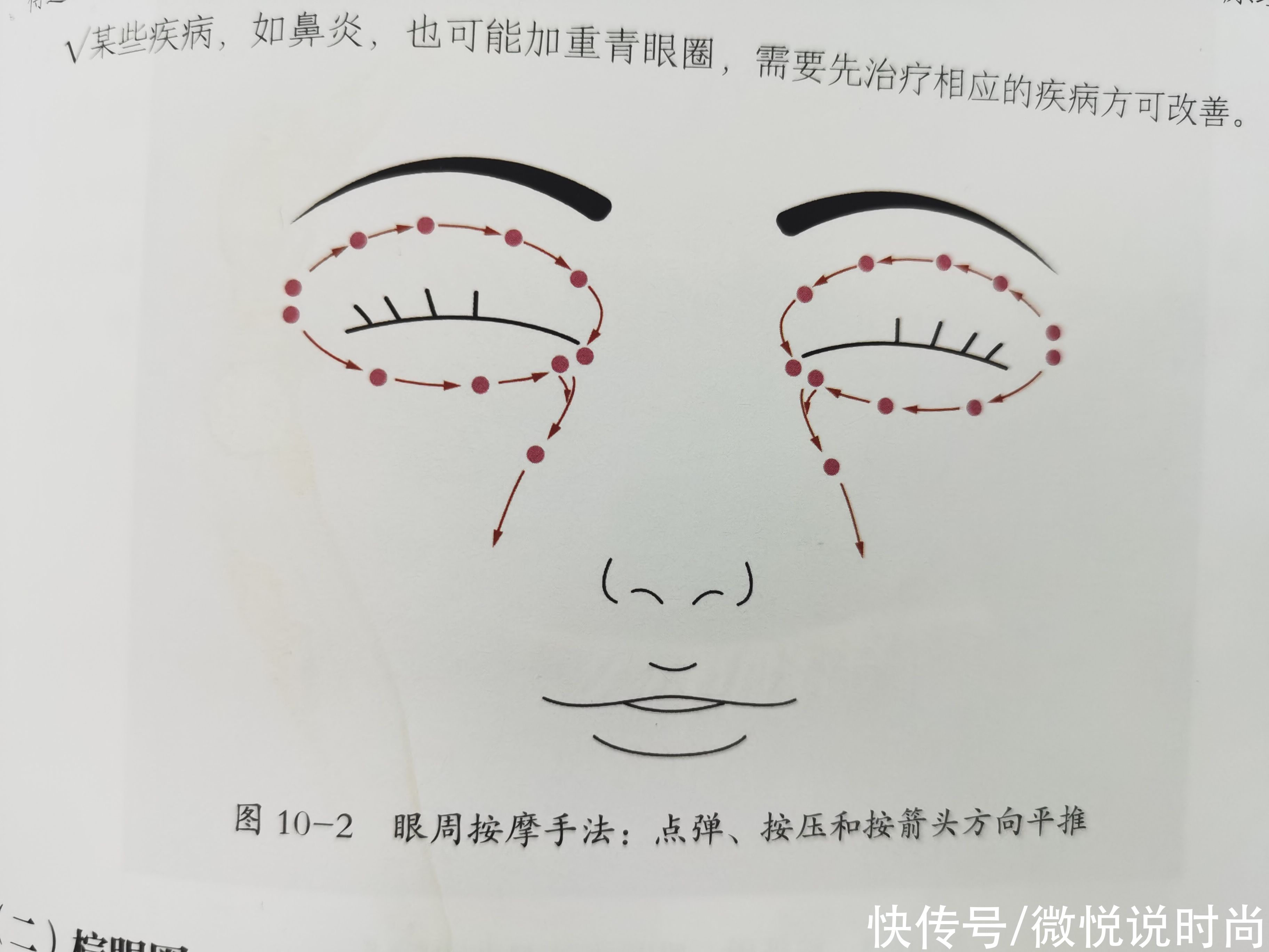 黑眼圈很严重怎么办？怎么拯救特别严重的黑眼圈？