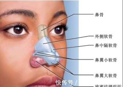 风险 鼻炎能做隆鼻手术吗隆鼻之后会有哪些术后风险!