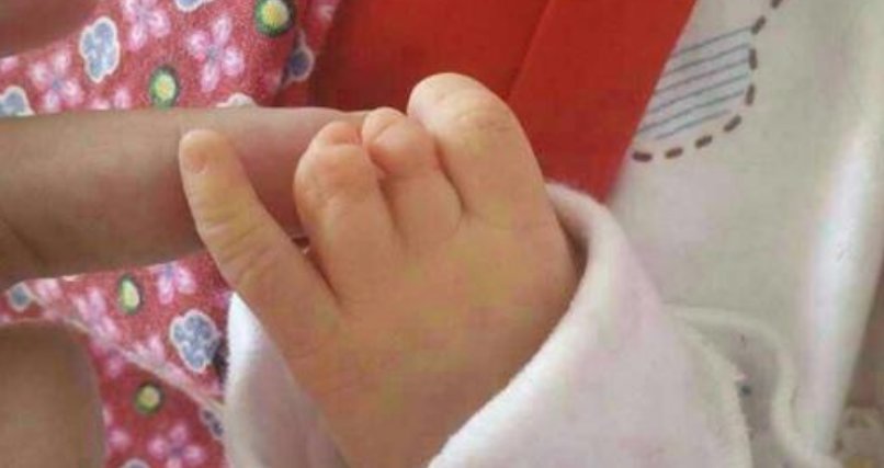 侏儒症|产检一切正常的新生儿多一个手指,爸爸要求医院赔偿,医生表示很冤枉