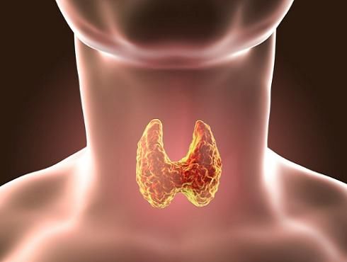 油炸食物|医生建议：这1素食尽量少吃，可能会加速甲状腺肿瘤的增长