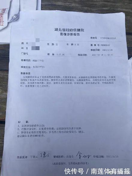 后遗症|因月嫂打瞌睡,出生6天宝宝被摔成颅骨骨折,宝妈:月嫂一天收费500元