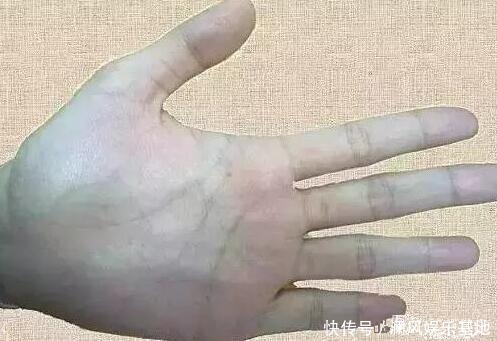 剧烈运动|手上青筋越明显说明身体越差？今天就给大家科普一下！