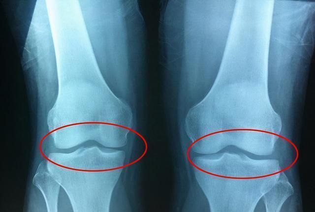 身高|森蝶12岁身高将近一米七,想要孩子长得好,要避免他成为这三类人