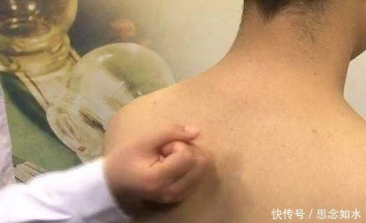 身体|身体出现3种“异常”,是肺不好,抓紧去看看医生