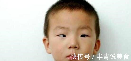 黑眼珠|5岁男孩一觉醒来,黑眼珠“消失”了,医生家长别太惯着孩子