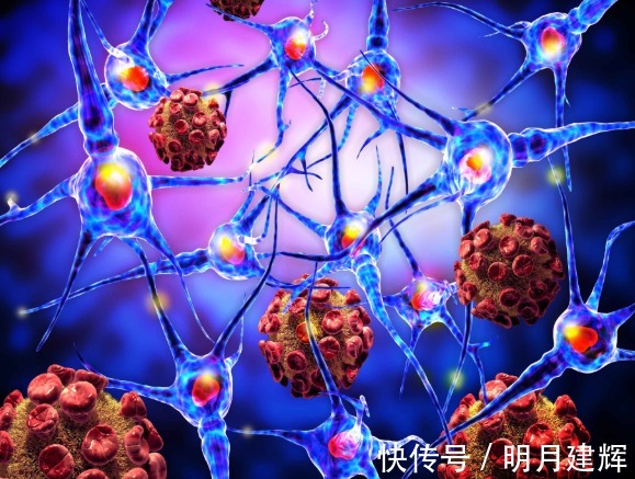 淋巴|3大恶性肿瘤是癌症界的“伪装者”，身体一旦出现异常，及时筛查