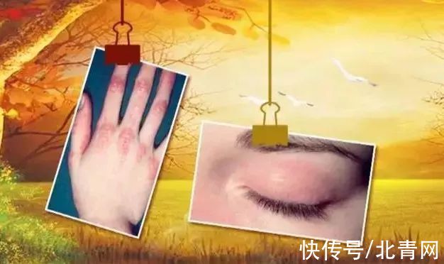 甲亢|各种疾病的早期信号,都在这里了!知道了省钱又救命,赶紧学起来