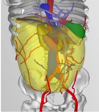 Retroperitoneal fat resection! Qilu Hospital performed retroperitoneal lipotomy for a patient with giant liposarcoma as the first case in the hospital