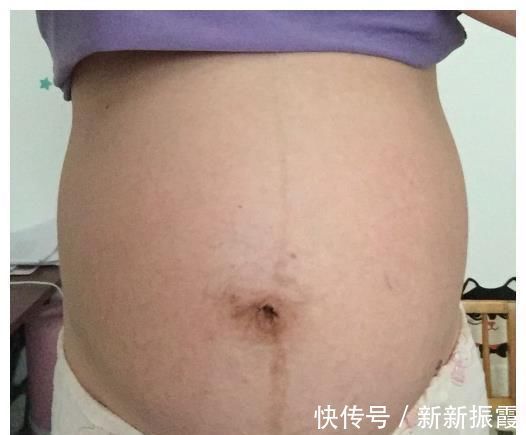 胎儿|“看你都胖啥样了，胎动能出现吗”太胖会影响胎动吗