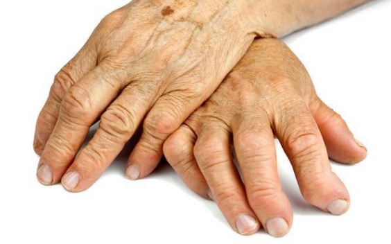 结子|血脂高不高,查看身上3个部位就知道,稳定血脂谨记2少2多