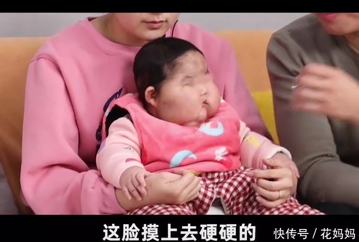 婴儿|“消”字号婴儿霜，致5个月宝宝全身发胖，发育迟缓，脸上长毛