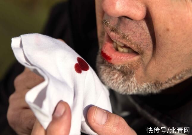 近期有以下四个症状到来,当心可能是肺部癌变之后的信号