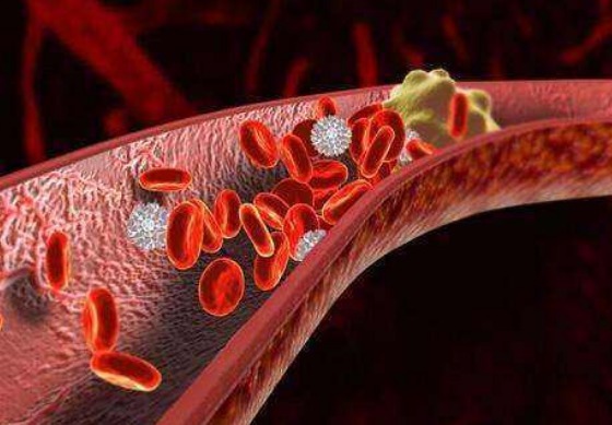血栓|天然“阿司匹林”找到了，喝水时加点，冲走血栓，清理血管垃圾！