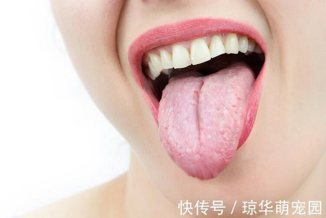 湿气重|中医提醒:体内湿气重,有几类水果不建议多碰!或许你爱吃