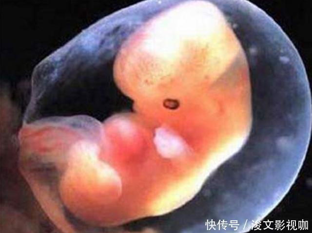 胎儿|孕期做到“4不碰”，有利于保持羊水“清澈”，胎儿住着更干净