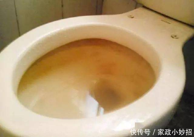 马桶用久了，黄渍顽固难清洗？撒点这“东西”，污垢异味轻松去除