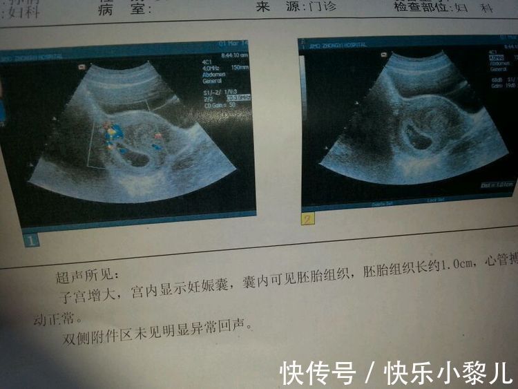 b超|怀孕40周B超检查全攻略,B超产检目的和注意事项,孕妈要知道
