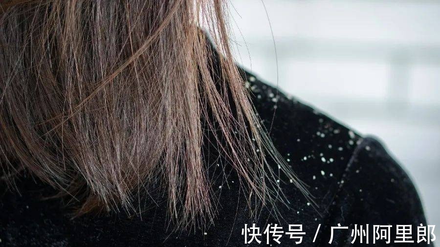 真菌|关于头屑,这篇全是干货!