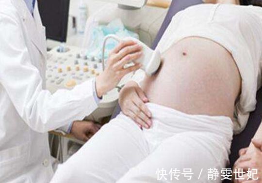 丈夫|产检时最好“守规矩”，这样的准妈妈，医生看了都要“躲着走”