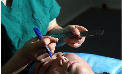 自体脂肪填充还会失败？其实先了解清楚这4件事，可以提高成功率