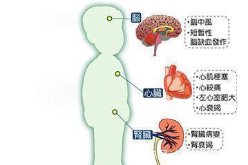 症状|你以为血压高只有头晕？医生提醒：出现这些症状，或是血压高信号