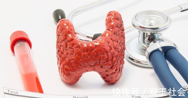 甲状腺激素|天天吃山楂可以消除结节？医生提醒：想要远离结节，不妨常吃3物