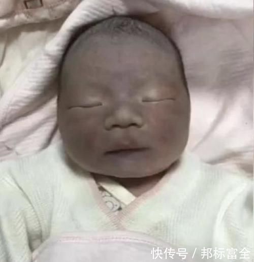 口腔|“黑脸宝宝”走红，长开后变成小帅哥，网友：还好父母忍住没扔