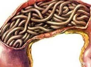 孩子|4岁孩子频繁肚子疼，大夫检查表示很危险，奶奶突然瘫在地上