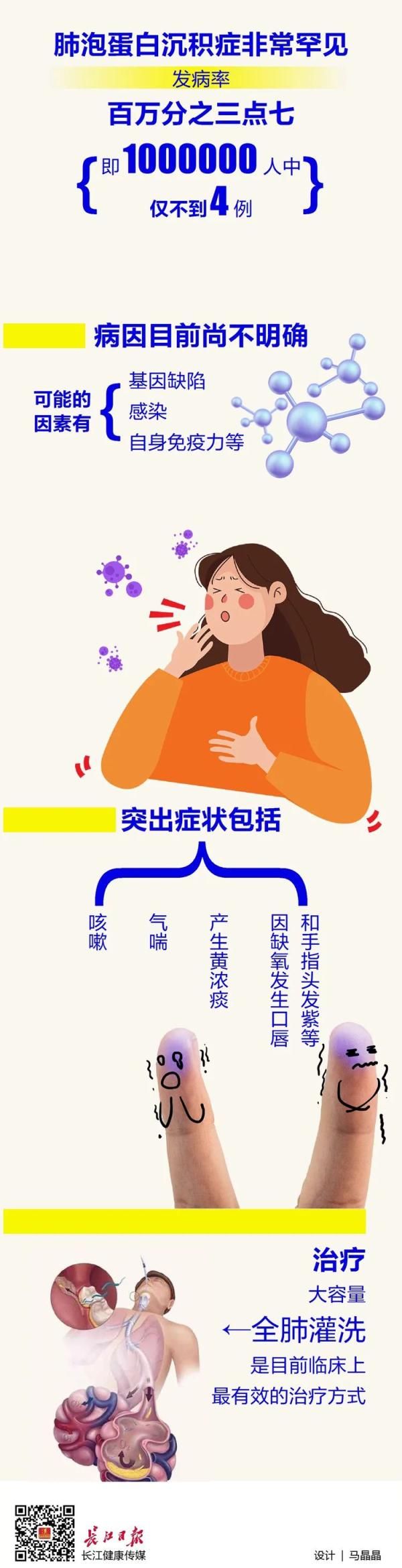 肺泡蛋白|胸闷气喘半年,男子肺里洗出19升“牛奶”
