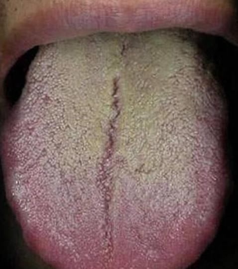 阴陵泉穴|每天坚持按摩这几个穴位几分钟,有效排出体内湿寒之气,美容瘦身