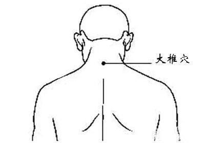 汗从哪里出，病从哪里来爱出汗的，快对照看看吧