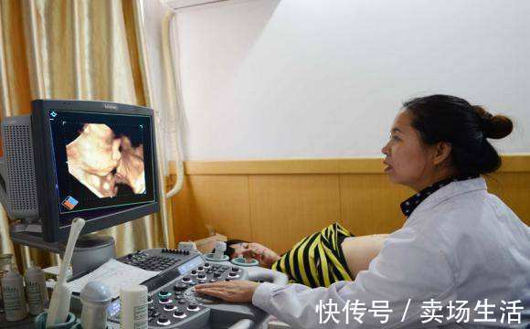 检查|四维彩超太难通过过来人提前做好这3件事,免得折腾太久