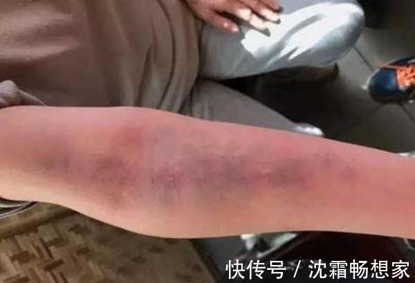 祛湿|白水加1物,湿气走光光!祛湿排毒,美容养颜,值得一试!