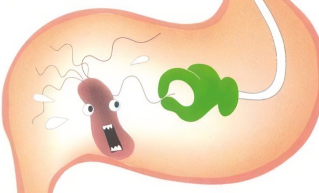 胃溃疡|被美国列入致癌物清单，中国感染率接近60%，幽门螺旋杆菌怎么防？