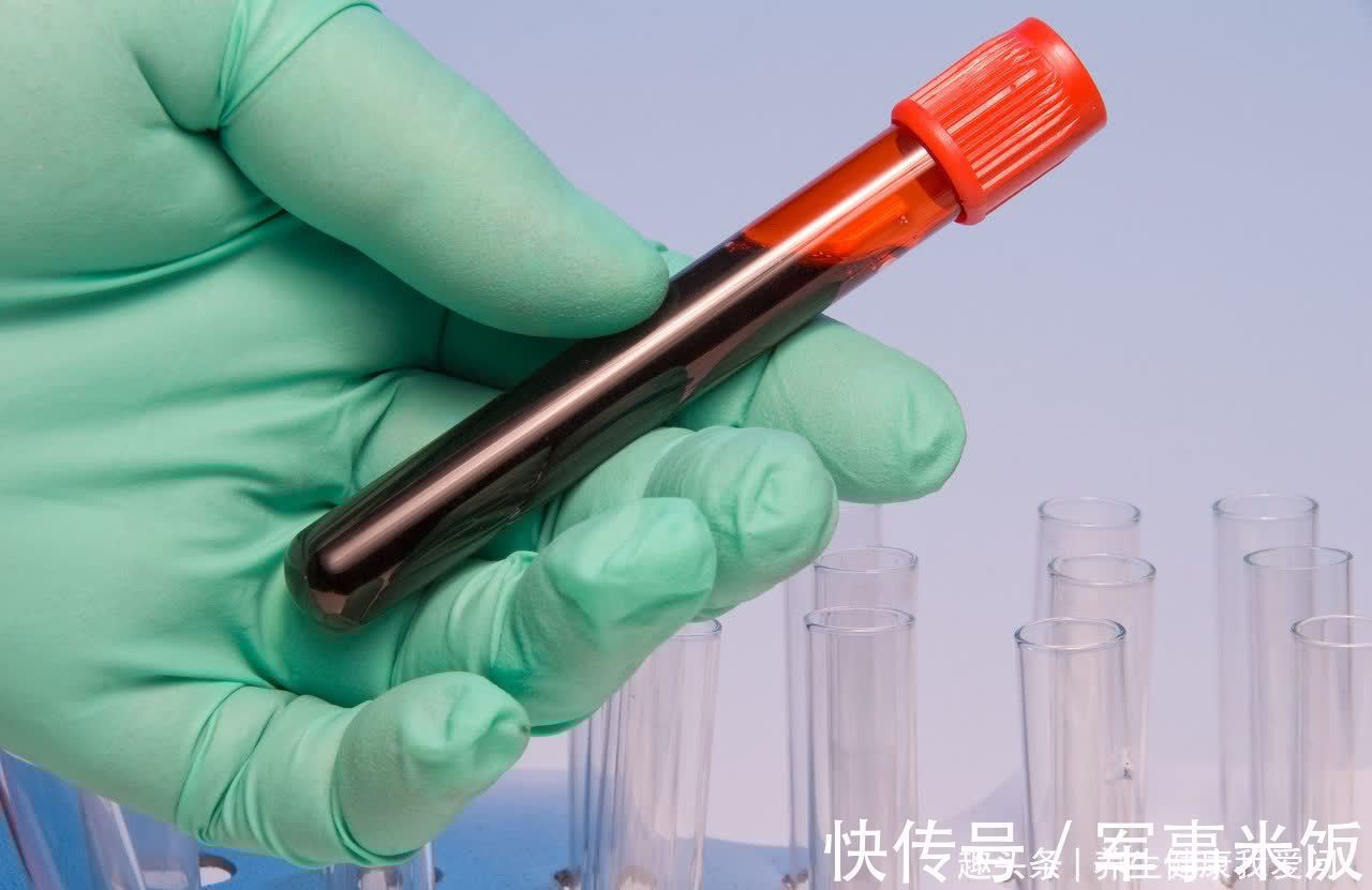 患癌|血型决定患癌几率和寿命?A型、B型、AB型、O型,哪种更长寿