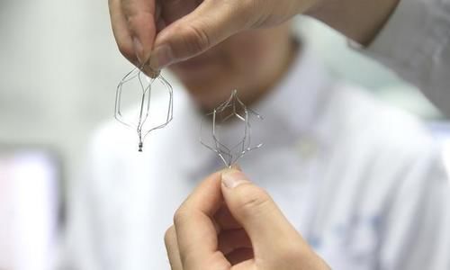 部位|血管有没有堵塞,看身体哪个部位就能知道?心血管医生告诉你