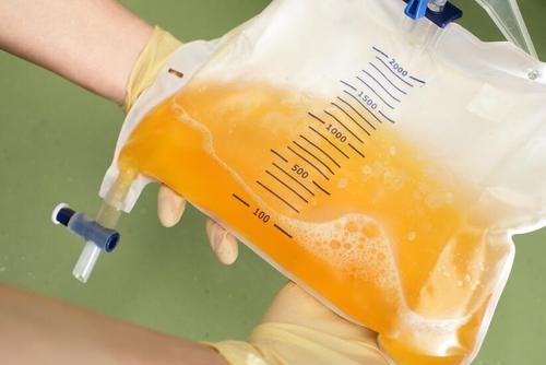  肾功能|注意：2件事伤肾还会升尿蛋白，不重视小心被肾衰竭盯上