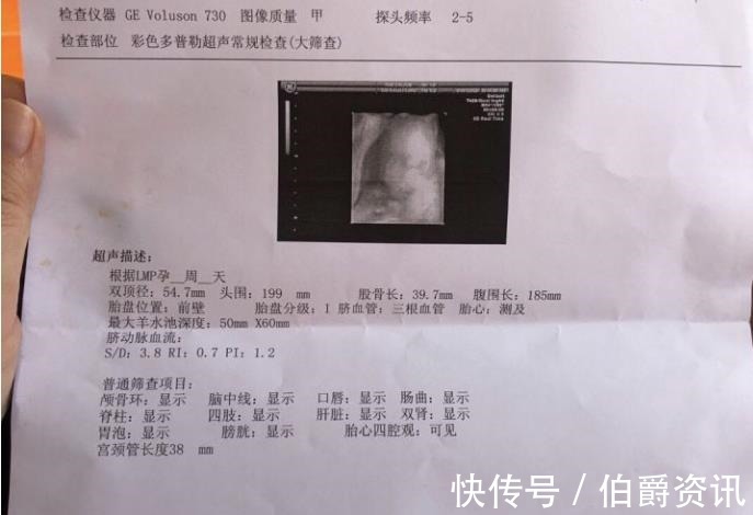 准妈妈|产检大排畸就是四维彩超吗产检你不知道的事儿,准妈妈看过来