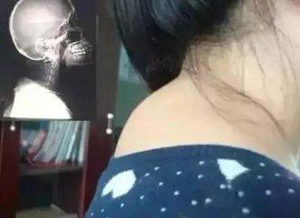 纱布|“十个颈椎九个包”,厨房中拿瓶醋,此法能治好,早知早受益