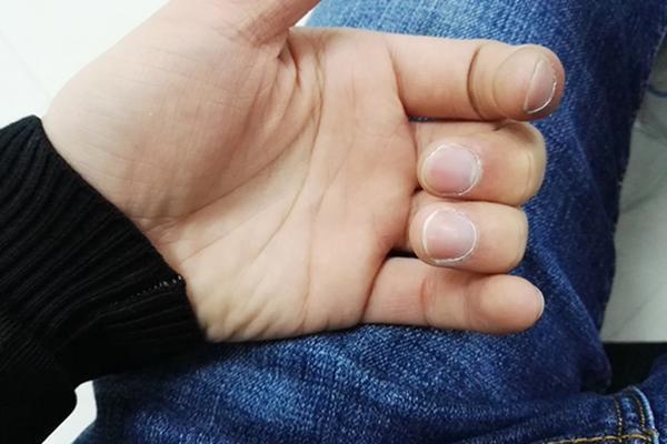 手掌|身体好不好,伸出手看看手掌“这块肉”,一看便知,别忽视