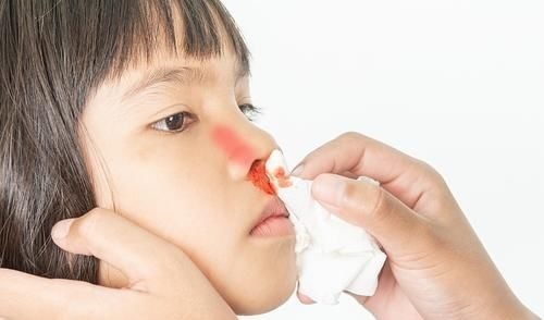 粘膜|孩子经常流鼻血预示身体出现哪些问题呢？医生详细告诉你