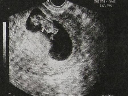 早期|怀孕早期这4项过关了，说明宝宝已经安家了，可以放心了