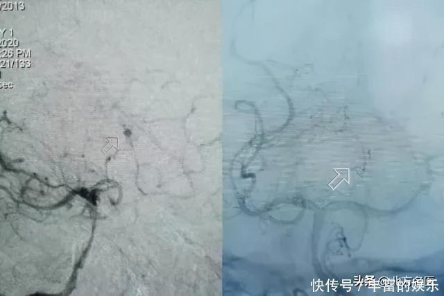 醒来|7岁男孩突然昏迷,醒来后说“妈妈,我要抱抱”