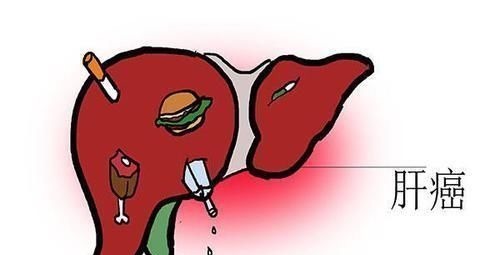 胰腺癌|查出癌症晚期，还有没有必要治疗答案很直白，别不接受