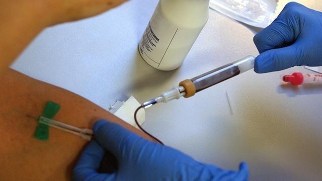 凝血功能|身上一处经常流血,可能肝炎已不是早期,再加上失眠更得小心